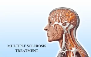 Best Multiple Sclerosis Treatment in Hyderabad