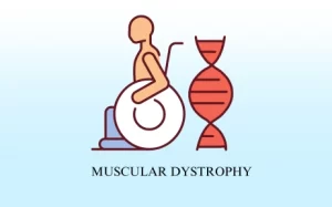 Muscular Dystrophy Treatment in Hyderabad