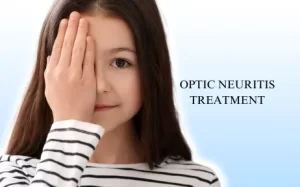 Optic Neuritis Treatment in Hyderabad