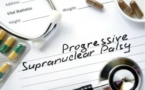 Progressive Supranuclear Palsy Treatment in Hyderabad