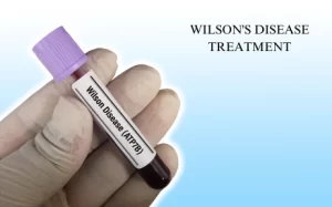 Wilson's Disease Treatment in Hyderabad